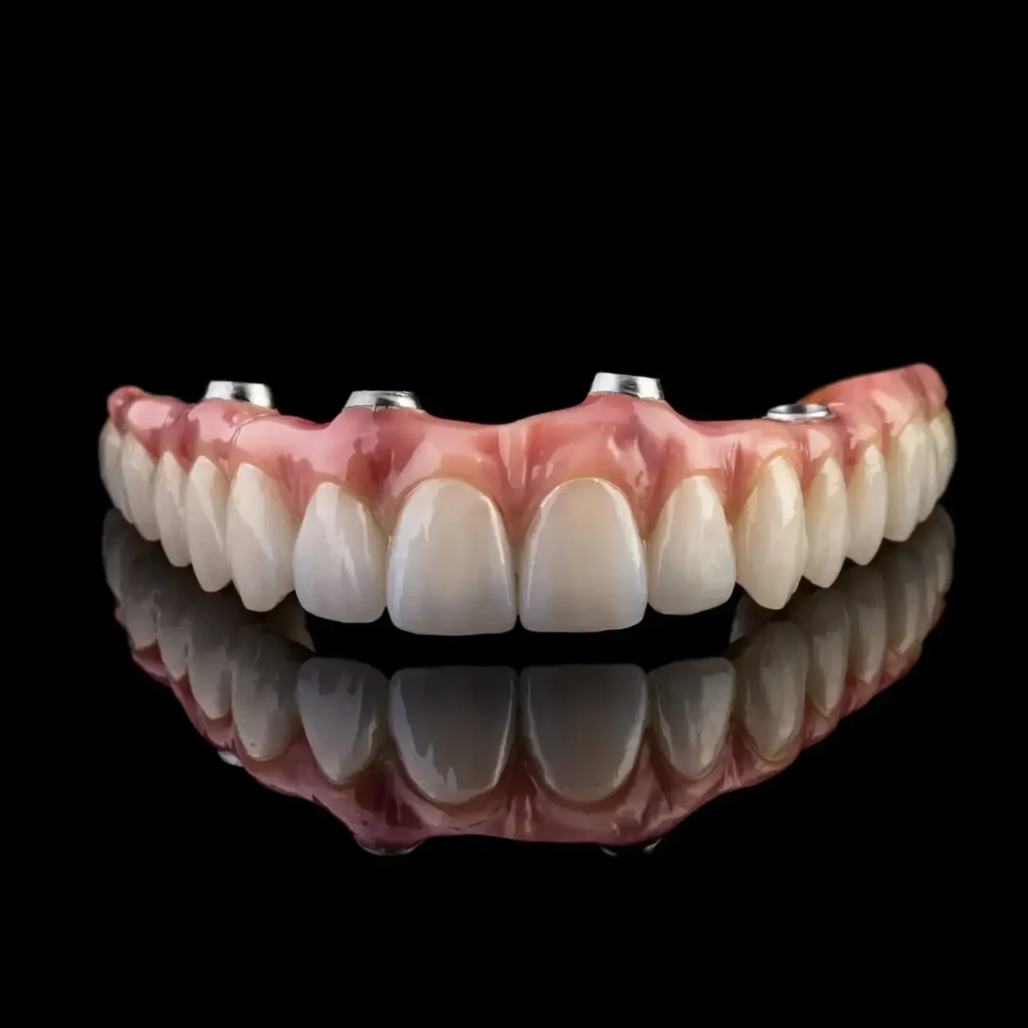 All-on-4 fixed zirconia implant bridge